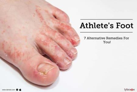 Peeing athletes feet