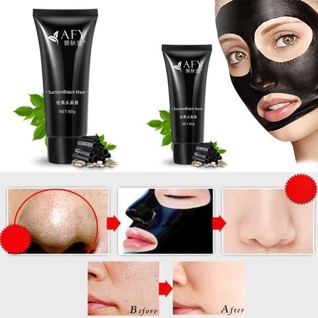 Blackhead facial treatment