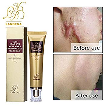 Coo C. reccomend Blackhead facial treatment