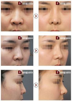 Nasal and facial plastic cosmetic surgery institute and laser center